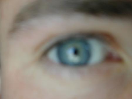MON oeil